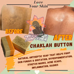 Chaklah Button Face & Body Bar